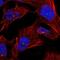 Zinc Finger Protein 285 antibody, NBP1-80605, Novus Biologicals, Immunofluorescence image 