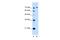 Glycosylphosphatidylinositol Anchor Attachment 1 antibody, A09298, Boster Biological Technology, Western Blot image 