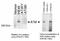 ATM Serine/Threonine Kinase antibody, NB100-309, Novus Biologicals, Immunoprecipitation image 