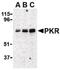 Eukaryotic Translation Initiation Factor 2 Alpha Kinase 2 antibody, PA5-20283, Invitrogen Antibodies, Western Blot image 