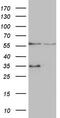 Vacuolar Protein Sorting 13 Homolog B antibody, M04566, Boster Biological Technology, Western Blot image 
