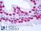Androgen Receptor antibody, LS-B7258, Lifespan Biosciences, Immunohistochemistry paraffin image 