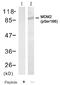 MDM2 Proto-Oncogene antibody, AP09495PU-N, Origene, Western Blot image 