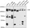 FER Tyrosine Kinase antibody, 23-894, ProSci, Western Blot image 