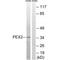 Peroxisomal Biogenesis Factor 2 antibody, A05851, Boster Biological Technology, Western Blot image 