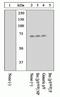 SRC Proto-Oncogene, Non-Receptor Tyrosine Kinase antibody, GTX24816, GeneTex, Western Blot image 