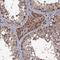 MIER Family Member 2 antibody, NBP2-47372, Novus Biologicals, Immunohistochemistry paraffin image 