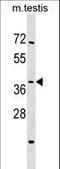 Sirtuin 4 antibody, LS-C158974, Lifespan Biosciences, Western Blot image 