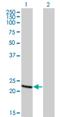 Recoverin antibody, H00005957-M01, Novus Biologicals, Western Blot image 