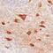 Von Willebrand Factor C Domain Containing 2 antibody, PA5-48096, Invitrogen Antibodies, Immunohistochemistry frozen image 