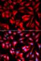Hyaluronan Mediated Motility Receptor antibody, LS-C747548, Lifespan Biosciences, Immunofluorescence image 