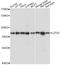 LZTS2 antibody, A07806-2, Boster Biological Technology, Western Blot image 