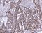 Amine Oxidase Copper Containing 1 antibody, A08386-1, Boster Biological Technology, Immunohistochemistry paraffin image 