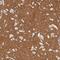 Tenascin R antibody, NBP1-86350, Novus Biologicals, Immunohistochemistry paraffin image 