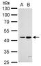 TNF Receptor Superfamily Member 25 antibody, GTX105713, GeneTex, Western Blot image 
