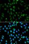 Proteasome Subunit Alpha 3 antibody, LS-B14860, Lifespan Biosciences, Immunofluorescence image 