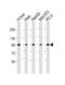 Glycogen phosphorylase, liver form antibody, M06317, Boster Biological Technology, Western Blot image 