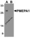 Prostate Transmembrane Protein, Androgen Induced 1 antibody, 8261, ProSci, Western Blot image 