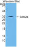 Serpin Family E Member 1 antibody, LS-C314536, Lifespan Biosciences, Western Blot image 