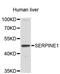 Serpin Family E Member 1 antibody, MBS127968, MyBioSource, Western Blot image 
