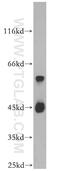 Beta-1,4-Galactosyltransferase 2 antibody, 20330-1-AP, Proteintech Group, Western Blot image 