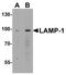 Lysosomal Associated Membrane Protein 1 antibody, A00780, Boster Biological Technology, Western Blot image 