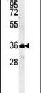 Myozenin 1 antibody, PA5-25172, Invitrogen Antibodies, Western Blot image 