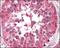 B-Raf Proto-Oncogene, Serine/Threonine Kinase antibody, NBP1-47433, Novus Biologicals, Immunohistochemistry frozen image 