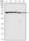 Cell Division Cycle 25C antibody, abx010324, Abbexa, Enzyme Linked Immunosorbent Assay image 