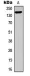 Treacle Ribosome Biogenesis Factor 1 antibody, orb304626, Biorbyt, Western Blot image 