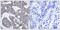 Heat Shock Protein Family B (Small) Member 1 antibody, GTX50277, GeneTex, Immunohistochemistry paraffin image 