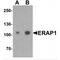 Endoplasmic Reticulum Aminopeptidase 1 antibody, MBS153542, MyBioSource, Western Blot image 
