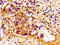 Cyclin Dependent Kinase Inhibitor 3 antibody, LS-C669961, Lifespan Biosciences, Immunohistochemistry paraffin image 