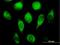 Cytochrome B5 Reductase 3 antibody, H00001727-B01P, Novus Biologicals, Immunocytochemistry image 