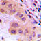 CTP Synthase 1 antibody, LS-C352065, Lifespan Biosciences, Immunohistochemistry paraffin image 
