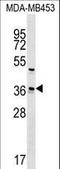 Ubiquitin Conjugating Enzyme E2 Z antibody, LS-C157314, Lifespan Biosciences, Western Blot image 