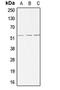 Activin A Receptor Like Type 1 antibody, LS-C351792, Lifespan Biosciences, Western Blot image 