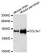 Collagen Type III Alpha 1 Chain antibody, A3795, ABclonal Technology, Western Blot image 