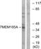 Transmembrane Protein 185A antibody, GTX87650, GeneTex, Western Blot image 