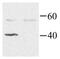 G Protein Subunit Alpha I2 antibody, PA1-28931, Invitrogen Antibodies, Western Blot image 