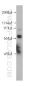 Tudor Domain Containing 3 antibody, 13359-1-AP, Proteintech Group, Western Blot image 