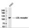 Low Density Lipoprotein Receptor antibody, orb10972, Biorbyt, Western Blot image 