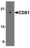 CD81 Molecule antibody, NBP1-77039, Novus Biologicals, Western Blot image 