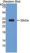 3-Hydroxy-3-Methylglutaryl-CoA Reductase antibody, LS-C373178, Lifespan Biosciences, Western Blot image 