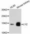 Lysozyme antibody, abx125359, Abbexa, Western Blot image 