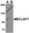 BCL2 Associated Transcription Factor 1 antibody, 8373, ProSci Inc, Western Blot image 