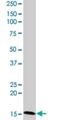 Cell Death Inducing DFFA Like Effector C antibody, H00063924-M07, Novus Biologicals, Western Blot image 