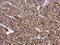 Heat Shock Protein Family B (Small) Member 1 antibody, GTX112964, GeneTex, Immunohistochemistry paraffin image 