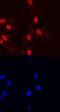 Paxillin antibody, MAB61641, R&D Systems, Immunocytochemistry image 