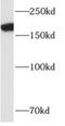 Alsin Rho Guanine Nucleotide Exchange Factor ALS2 antibody, FNab00350, FineTest, Western Blot image 
